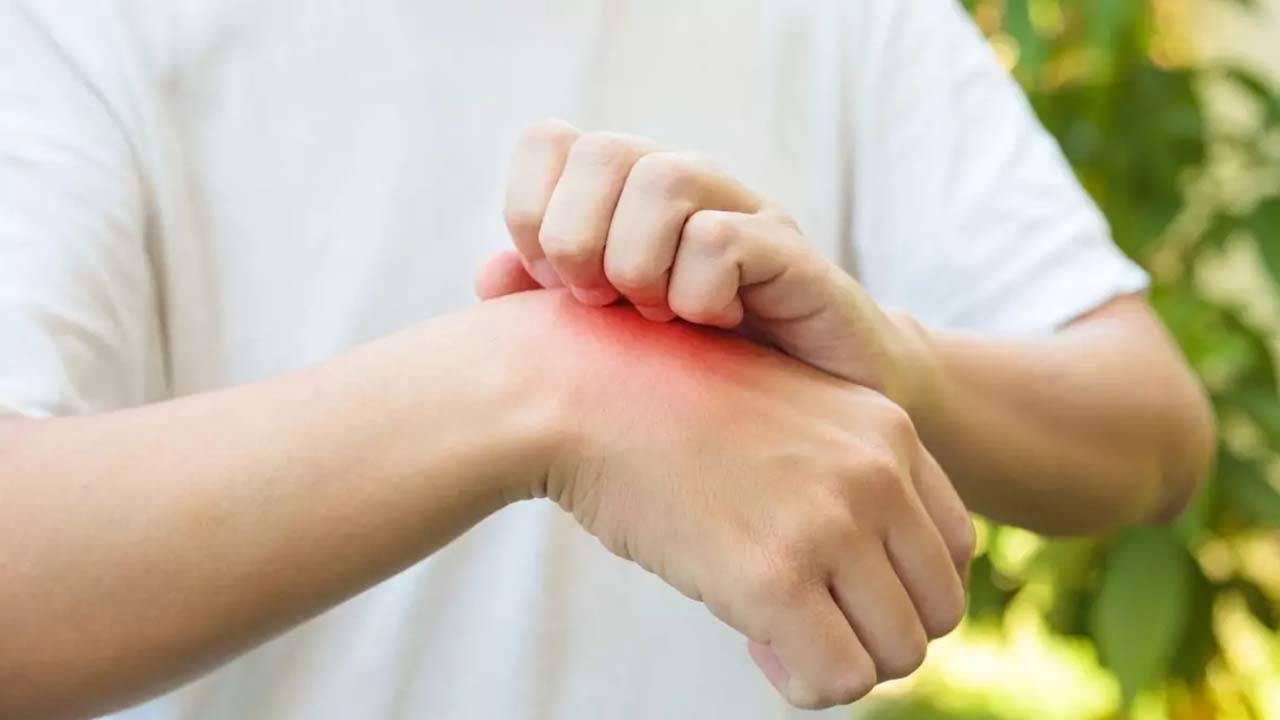 uzmanindan uyari behcet hastaligi 25 yas alti genc erkeklerde daha agir seyrediyor mED3ItWz